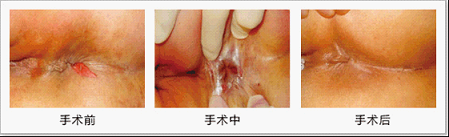 在线咨询