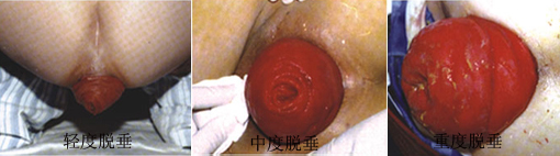 太原肛肠医院