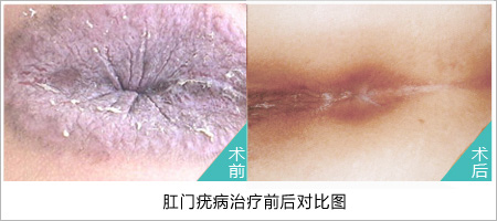 在线咨询