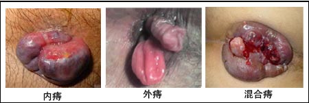 在线咨询
