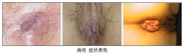 山西惠民肛肠专科医院