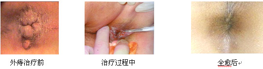 在线咨询